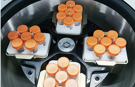 كيفية اختيار أنبوب الطرد المركزي