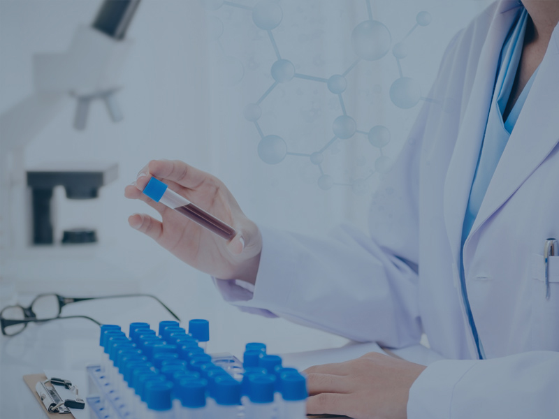 التطبيقات الصناعية للطرد المركزي الآلي