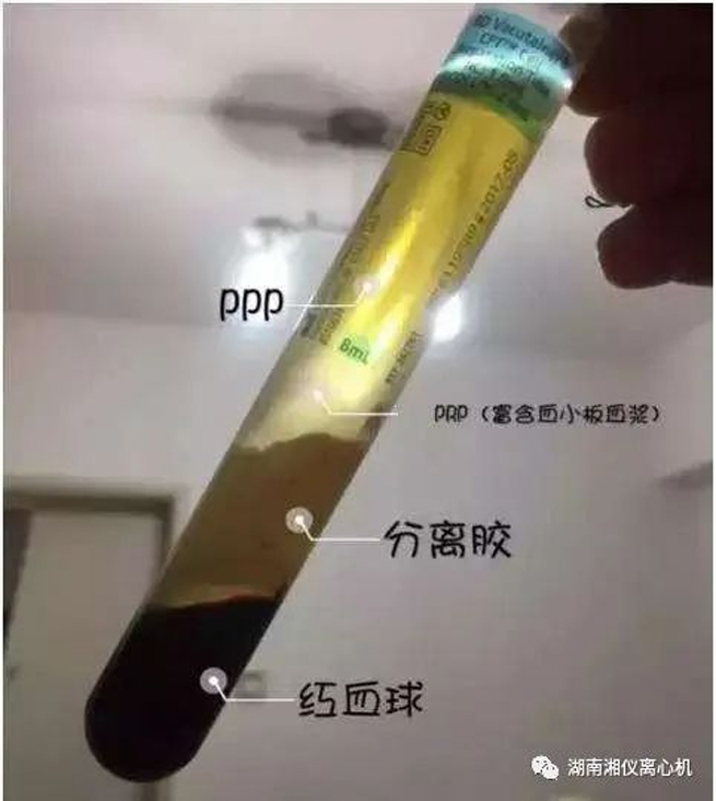 【 تعميم العلوم 】 PRP سيروم ذاتي الجمال